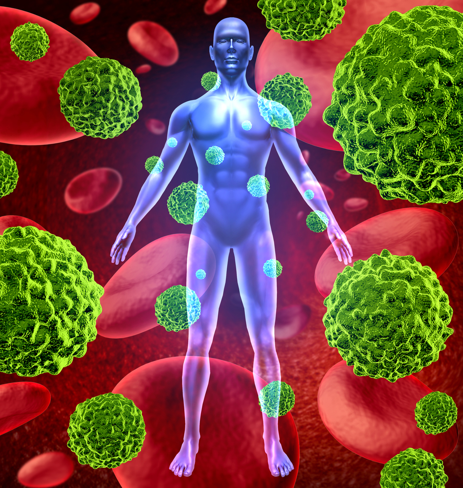 Человеческое тело с раковыми клетками