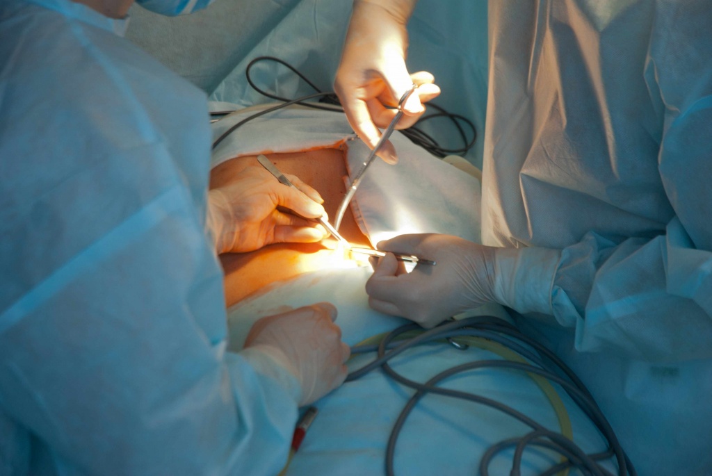 Медсестра держит хирургический инструмент