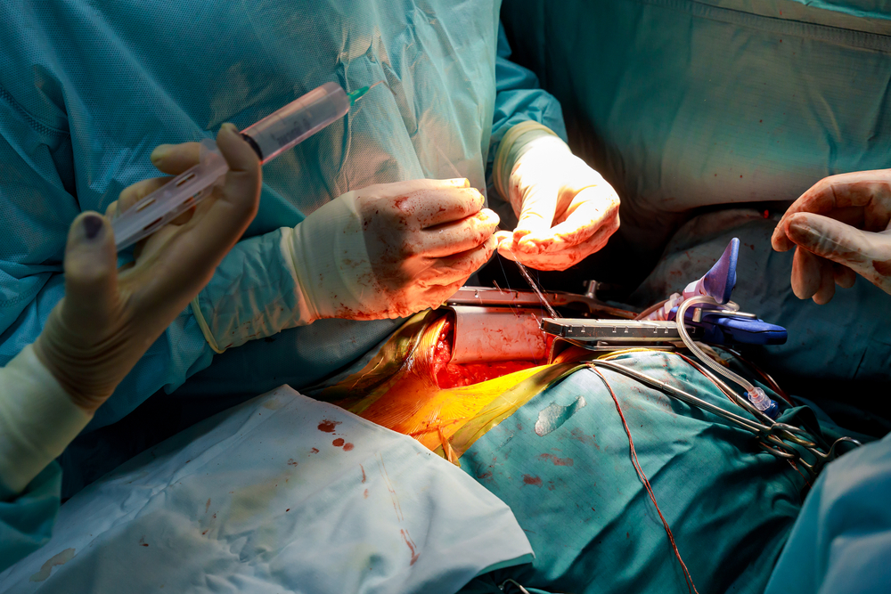 Хирург накладывает инвагинационно-клапанный анастомоз